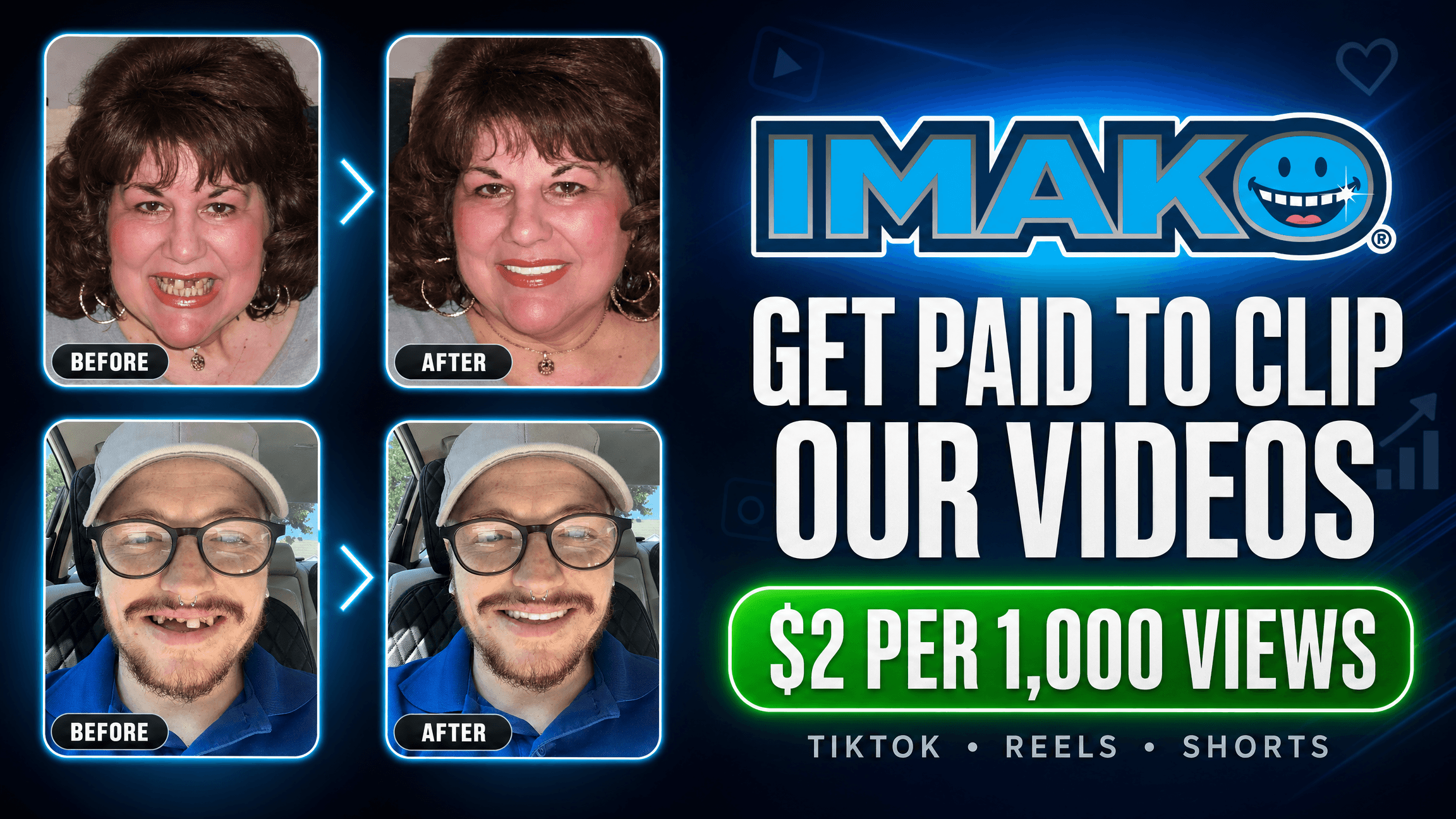 IMAKO Cosmetic Teeth — Clip-On Smile Transformations | $2.00 / 1K